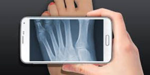 App for doctors helps them share x-rays, scans on the go